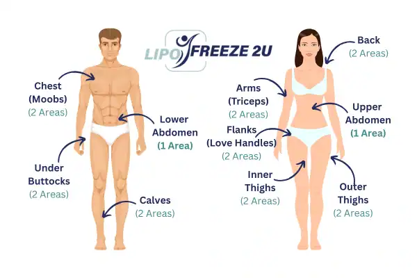 Areas you can have fat freezing treatment
