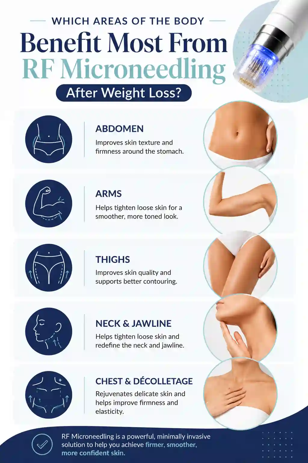 Which Areas of the Body Benefit Most From RF Microneedling After Weight Loss
